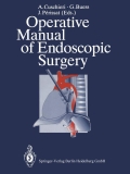 Cuschieri, Buess, P�rissat (Hg.): Operative manual of endoscopic surgery
